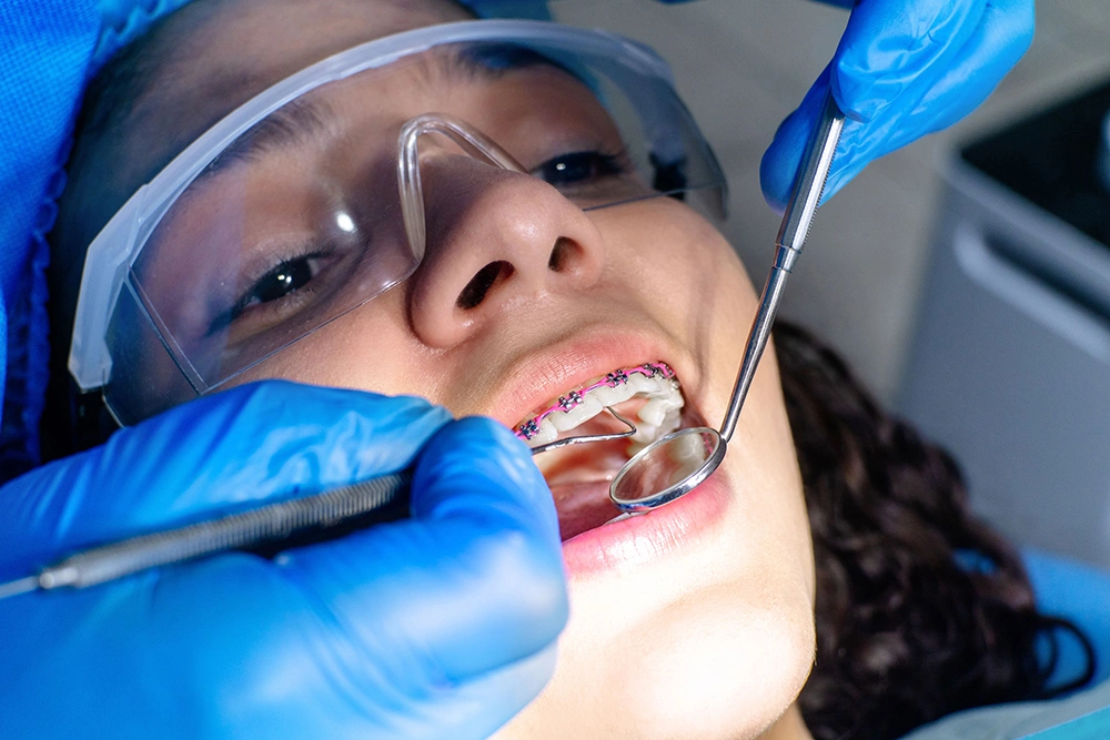 closeup-shot-of-a-dentist-doing-an-oral-examinatio